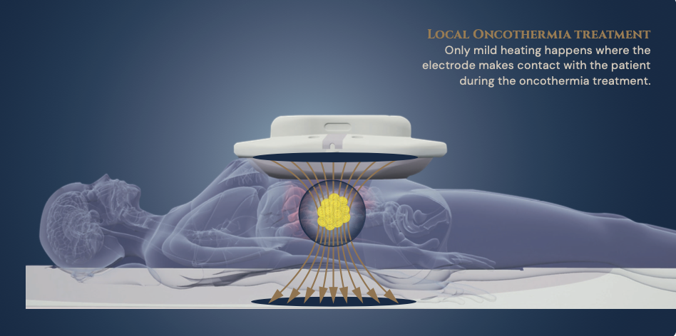 ONCOTHERM EHY-2030 MODEL