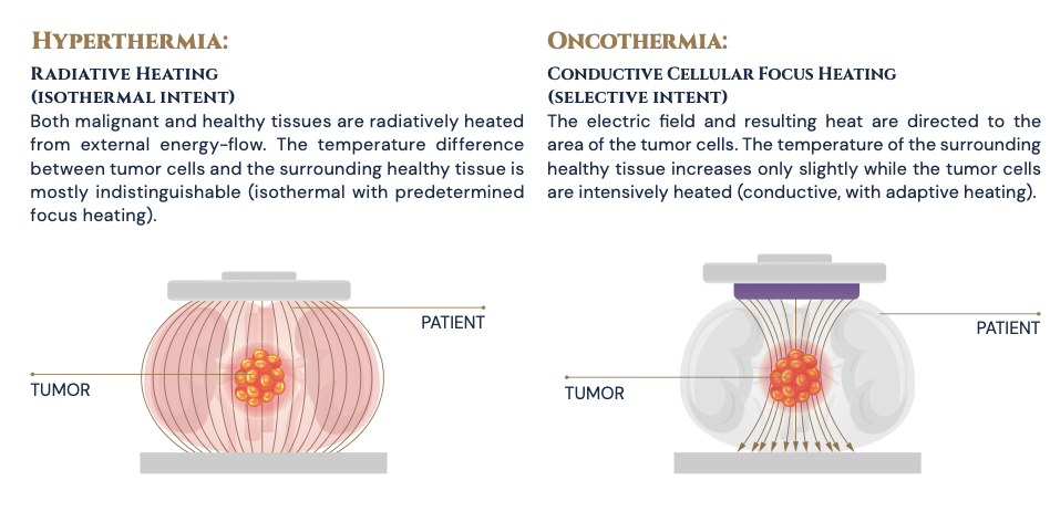 ONCOTHERM EHY-2030 MODEL